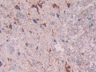 Polyclonal Antibody to Cathepsin D (CTSD)