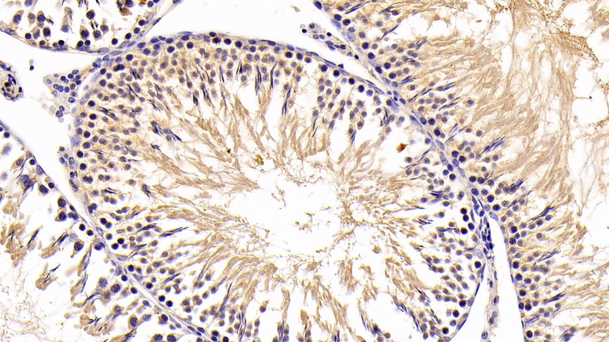 Polyclonal Antibody to Cathepsin D (CTSD)