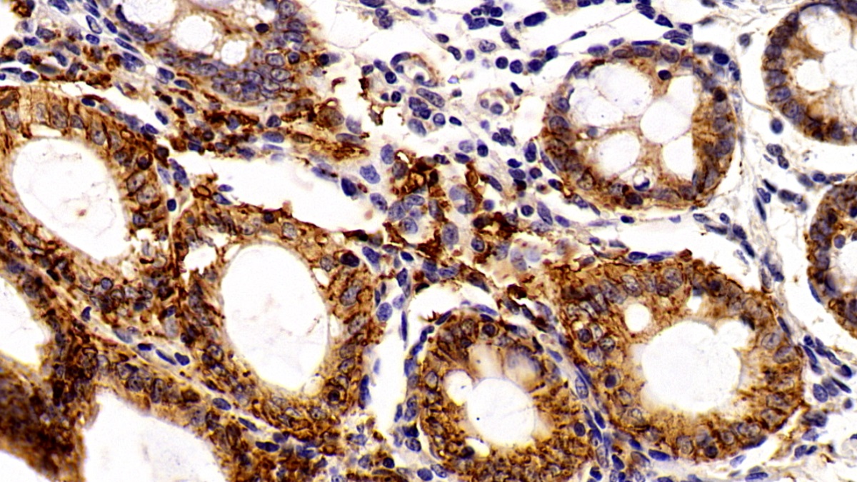 Polyclonal Antibody to Epithelial Cell Adhesion Molecule (EPCAM)