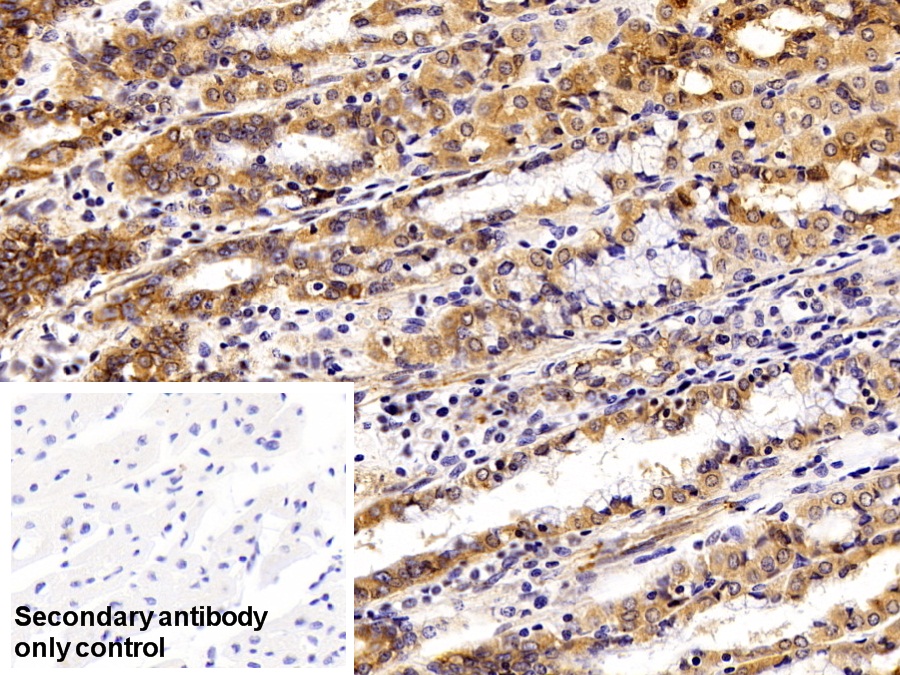 Polyclonal Antibody to Epithelial Cell Adhesion Molecule (EPCAM)