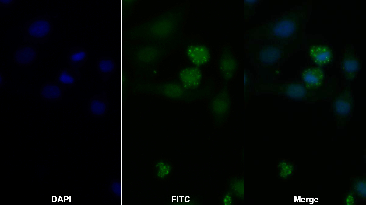 Polyclonal Antibody to V-Fos FBJ Murine Osteosarcoma Viral Oncogene Homolog (FOS)