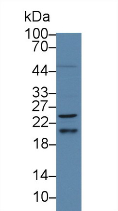 Polyclonal Antibody to V-Ha-Ras Harvey Rat Sarcoma Viral Oncogene Homolog (HRAS)