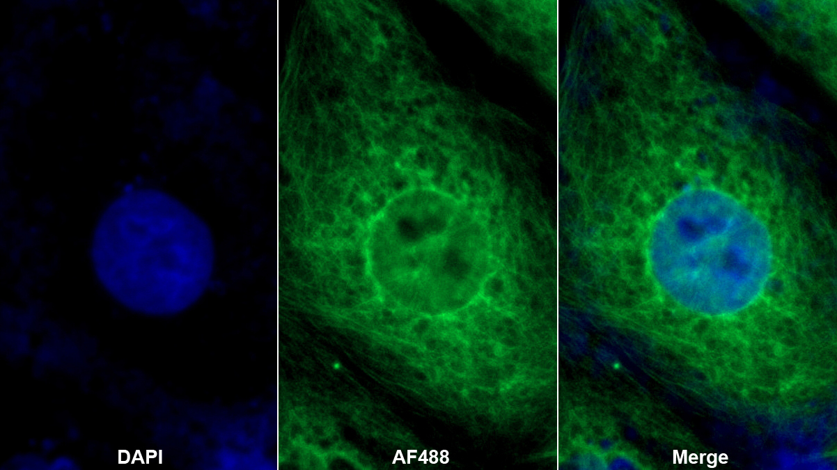 Polyclonal Antibody to Agouti Related Protein (AGRP)