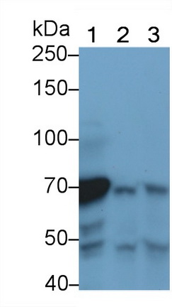 Polyclonal Antibody to Complement C4-B (C4B)