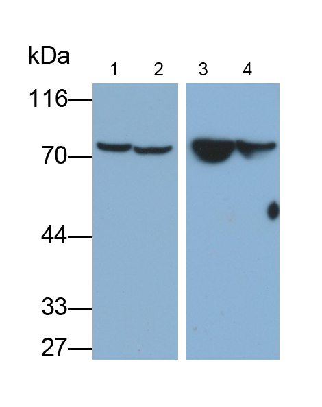 Polyclonal Antibody to Complement C4-B (C4B)