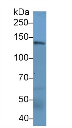 Polyclonal Antibody to Neurofilament 3 (NEF3)