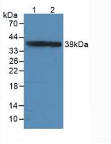 Polyclonal Antibody to Growth Associated Protein 43 (GAP43)