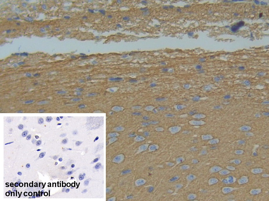Polyclonal Antibody to Growth Associated Protein 43 (GAP43)