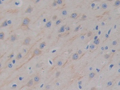 Polyclonal Antibody to Microtubule Associated Protein 2 (MAP2)