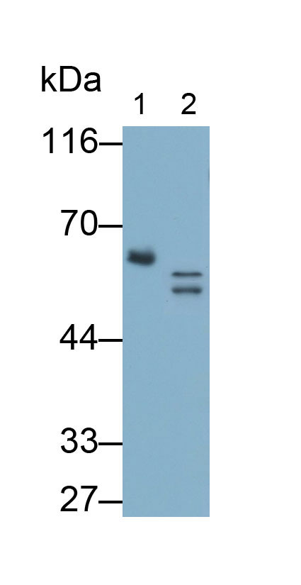 Polyclonal Antibody to Involucrin (INV)