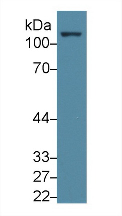 Polyclonal Antibody to Focal Adhesion Kinase (FAK)
