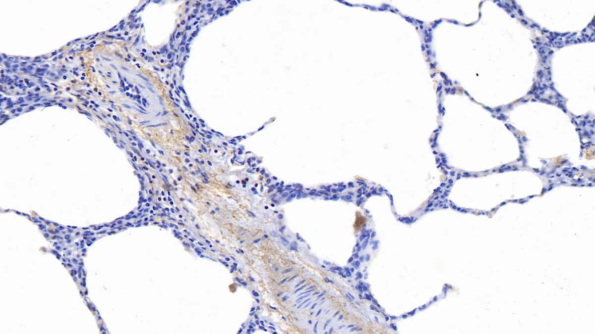 Polyclonal Antibody to Elastin (ELN)