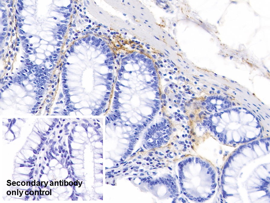 Polyclonal Antibody to Elastin (ELN)