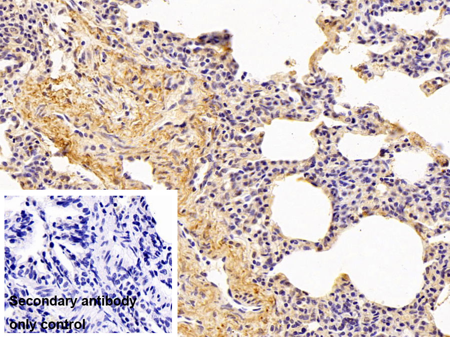 Polyclonal Antibody to Elastin (ELN)