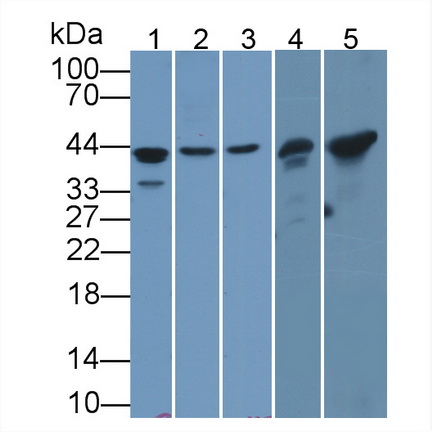 Polyclonal Antibody to Actin Alpha 1, Cardiac Muscle (ACTC1)