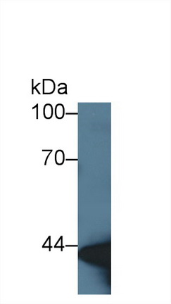 Polyclonal Antibody to Actin Alpha 2, Smooth Muscle (ACTa2)