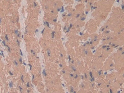 Polyclonal Antibody to Actin Alpha 2, Smooth Muscle (ACTa2)