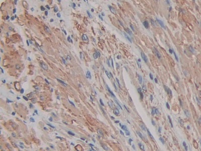 Polyclonal Antibody to Actin Gamma 2, Smooth Muscle (ACTg2)