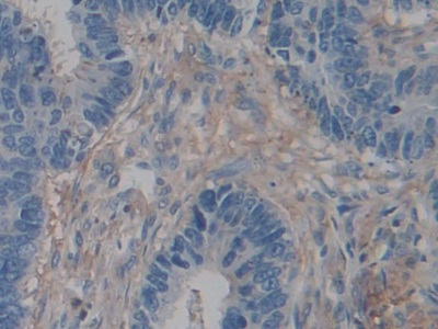 Polyclonal Antibody to Actin Gamma 2, Smooth Muscle (ACTg2)