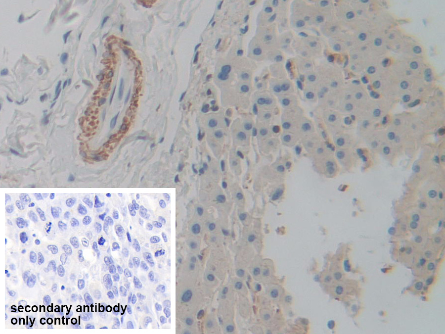 Polyclonal Antibody to Actin Gamma 2, Smooth Muscle (ACTg2)