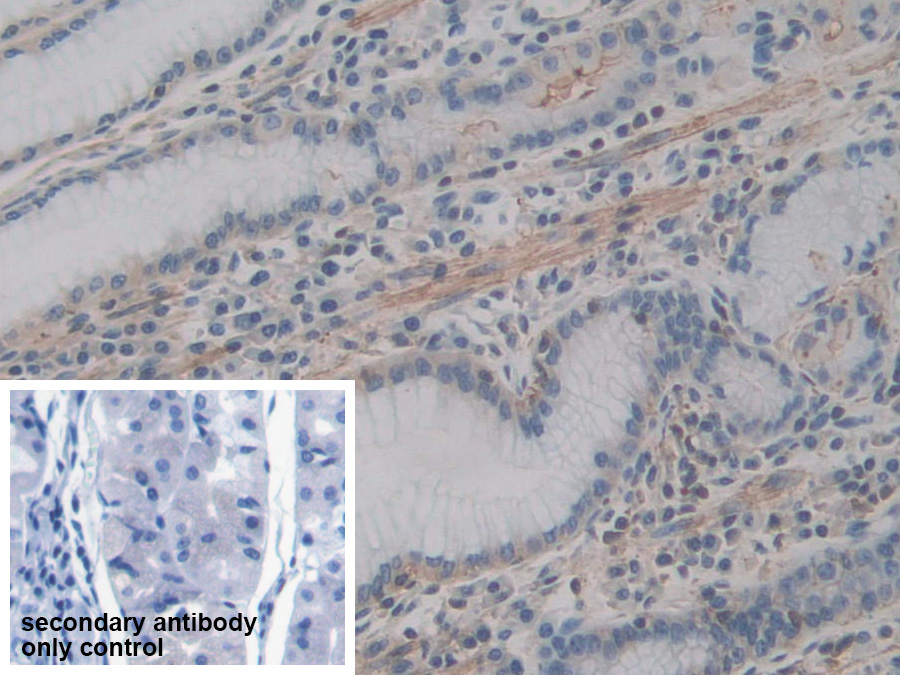 Polyclonal Antibody to Actin Gamma 2, Smooth Muscle (ACTg2)