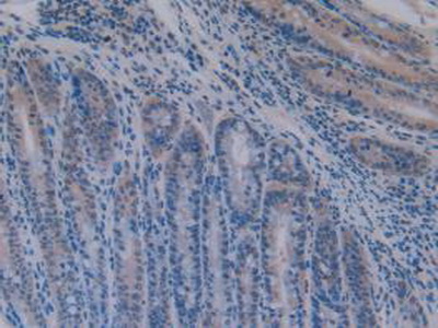 Polyclonal Antibody to Activating Transcription Factor 1 (ATF1)