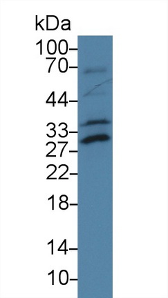 Polyclonal Antibody to Activating Transcription Factor 1 (ATF1)