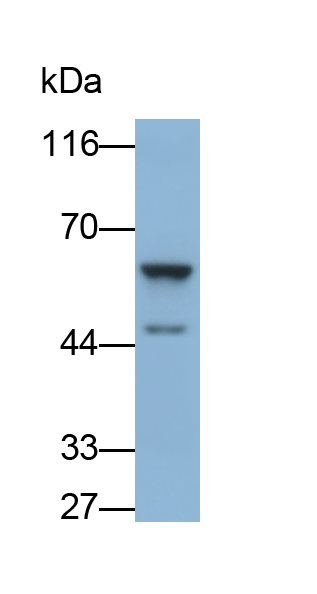 Polyclonal Antibody to Adenylyl Cyclase Associated Protein 1 (CAP1)