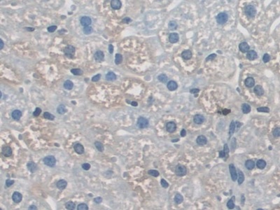 Polyclonal Antibody to Apoptosis Signal Regulating Kinase 1 (ASK1)