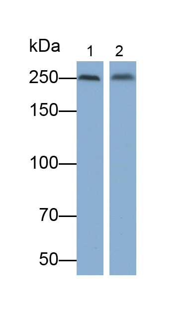 Polyclonal Antibody to Vascular Endothelial Growth Factor Receptor 2 (VEGFR2)