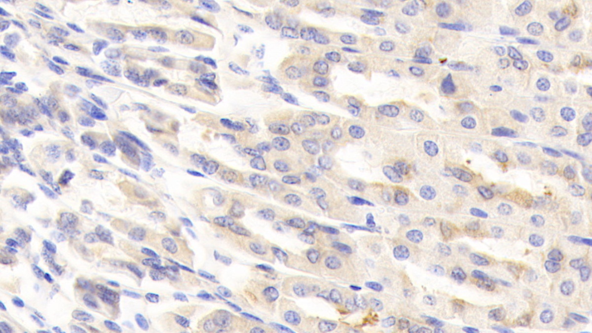 Polyclonal Antibody to Ephrin Type A Receptor 1 (EPHA1)