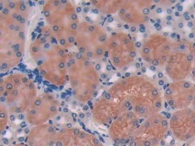 Polyclonal Antibody to Cluster Of Differentiation 74 (CD74)