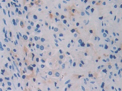 Polyclonal Antibody to Breast Cancer Susceptibility Protein 1 (BRCA1)