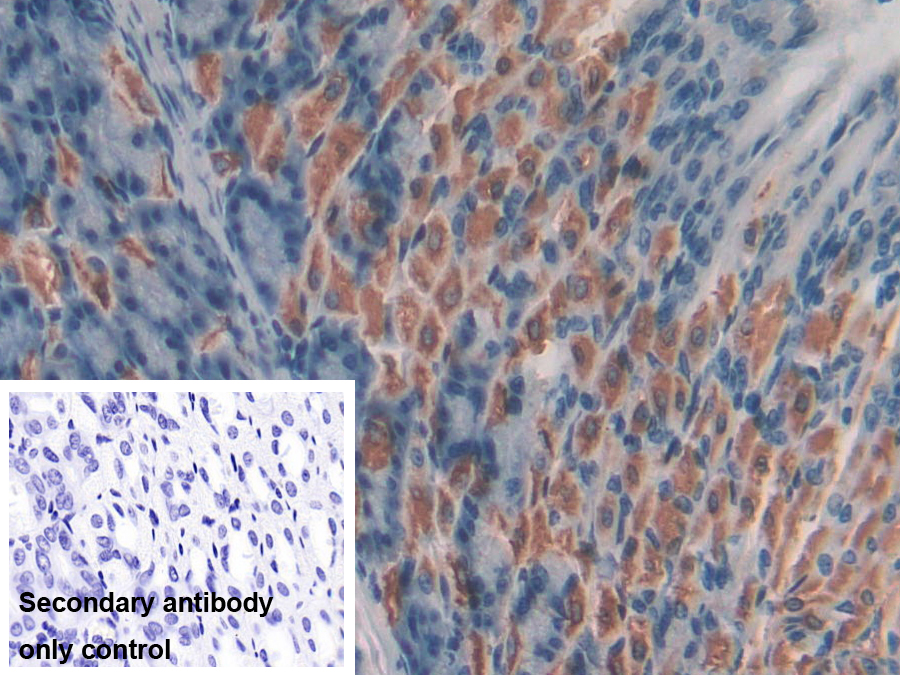 Polyclonal Antibody to Breast Cancer Susceptibility Protein 1 (BRCA1)