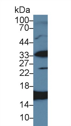 Polyclonal Antibody to Cluster of Differentiation 79B (CD79B)