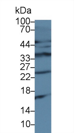 Polyclonal Antibody to Cluster of Differentiation 79B (CD79B)