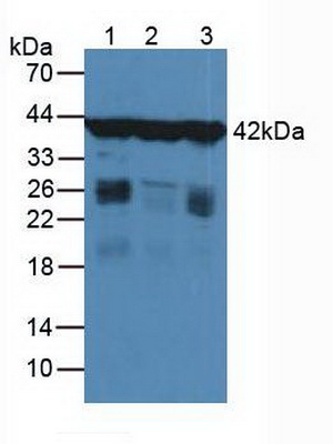 Polyclonal Antibody to Gamma Actin (ACTG)