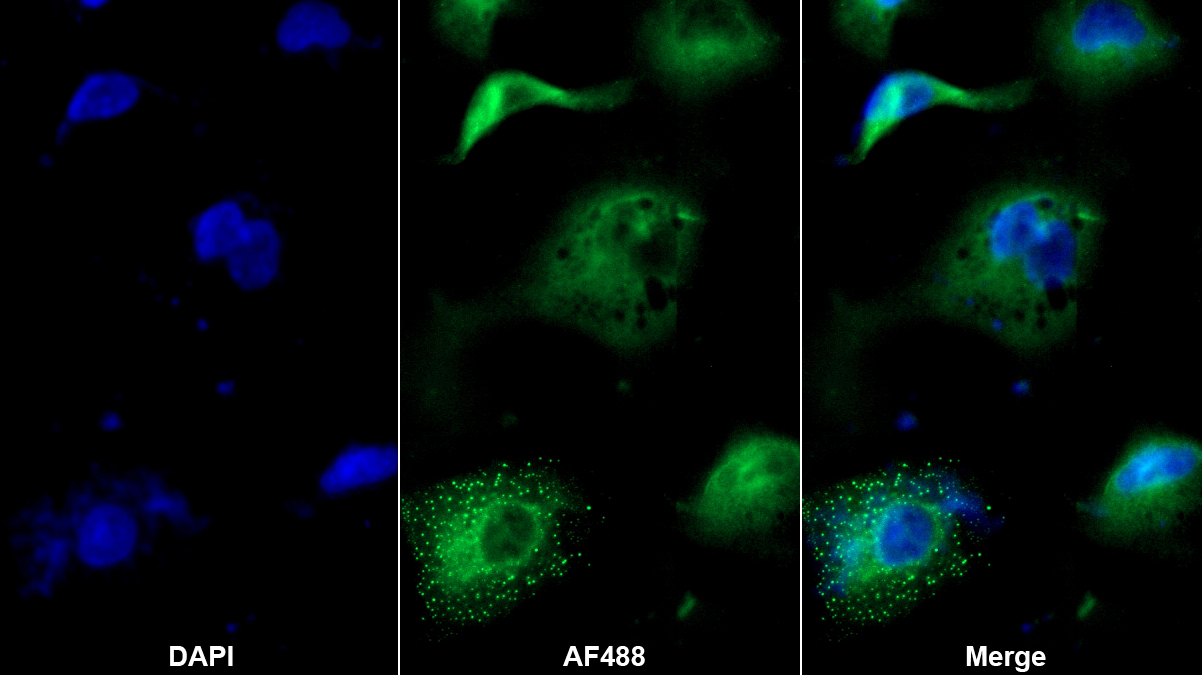 Polyclonal Antibody to Platelet Activating Factor Acetylhydrolase Ib3 (PAFAH1B3)