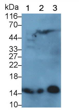 Polyclonal Antibody to Hemoglobin (HB)