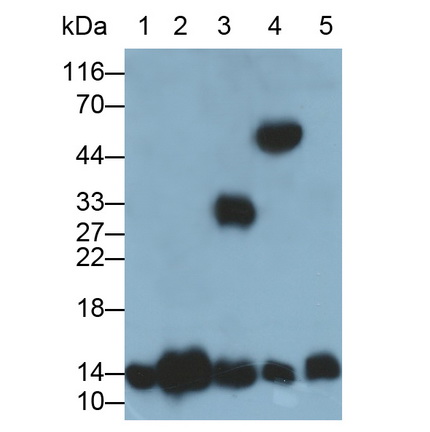 Polyclonal Antibody to Hemoglobin (HB)