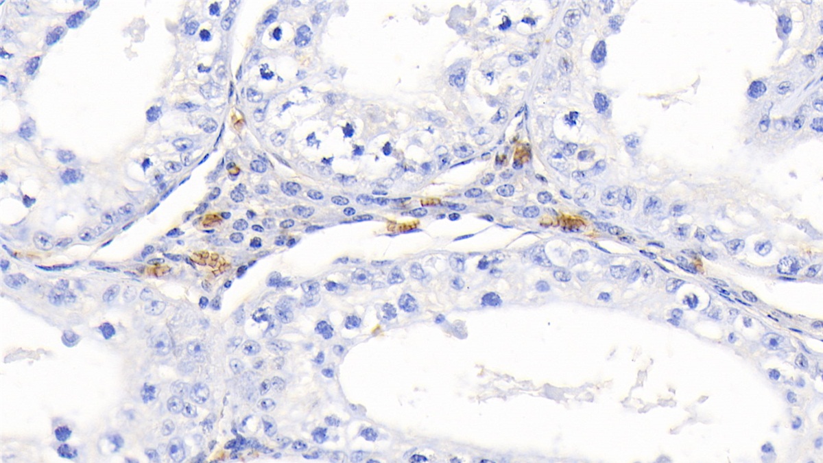 Polyclonal Antibody to Hemoglobin (HB)