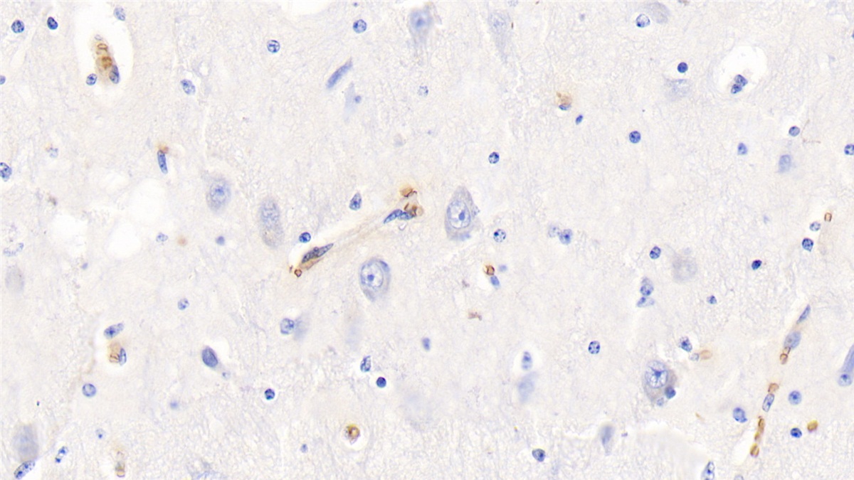 Polyclonal Antibody to Hemoglobin (HB)