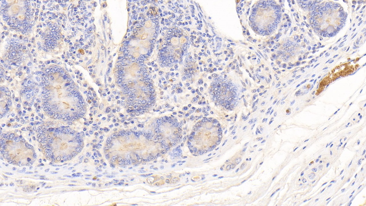 Polyclonal Antibody to Hemoglobin (HB)