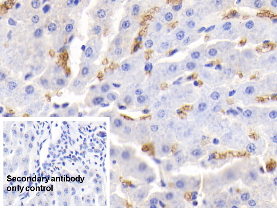 Polyclonal Antibody to Hemoglobin (HB)