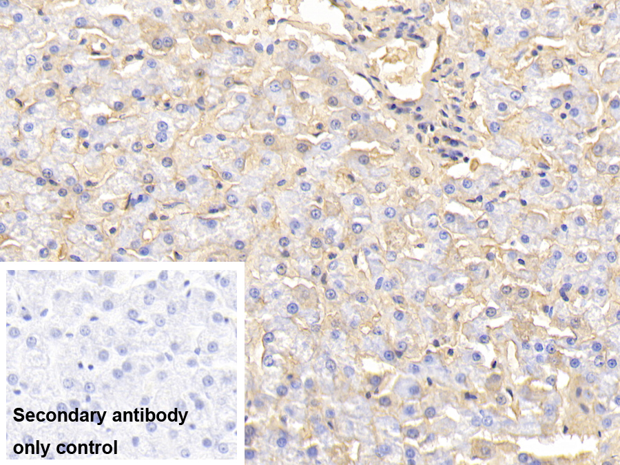 Polyclonal Antibody to Hemoglobin (HB)