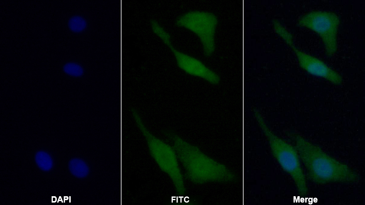 Polyclonal Antibody to Glucuronidase Beta (GUSb)