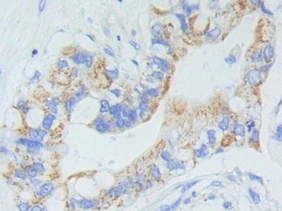 Polyclonal Antibody to Adenylate Cyclase 9 (ADCY9)