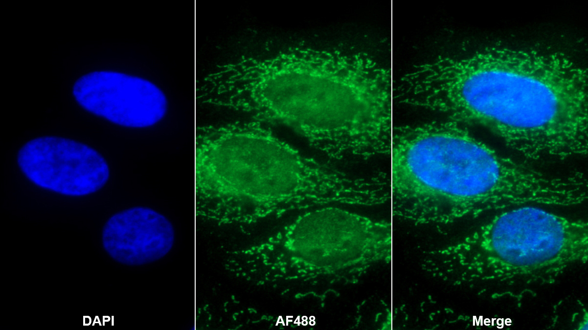 Polyclonal Antibody to Mitogen Activated Protein Kinase 7 (MAPK7)