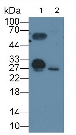 Polyclonal Antibody to Proteinase 3 (PR3)