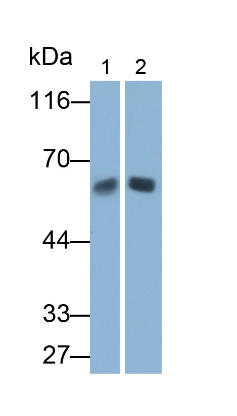 Polyclonal Antibody to Tyrosine Hydroxylase (TH)